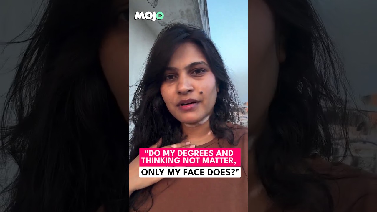 Watch This Girl's Viral Message After She Was Rejected By A Boy Due To A Skin Condition #shorts