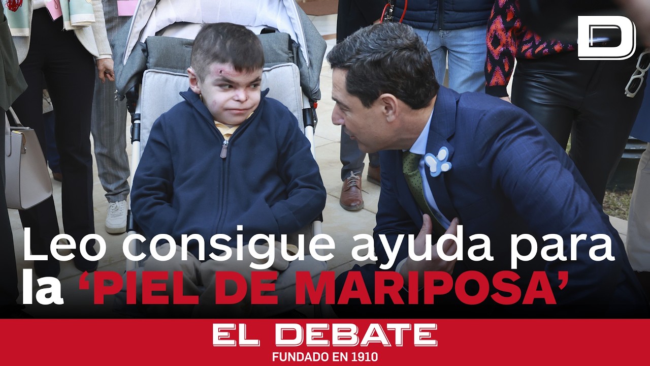 La lucha de Leo da sus frutos: Andalucía costeará el tratamiento de personas con 'piel de mariposa'