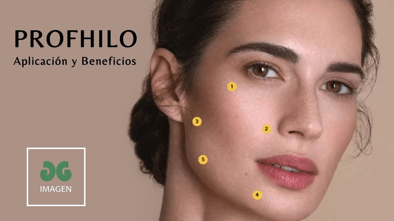 Profhilo: aplicación y beneficios