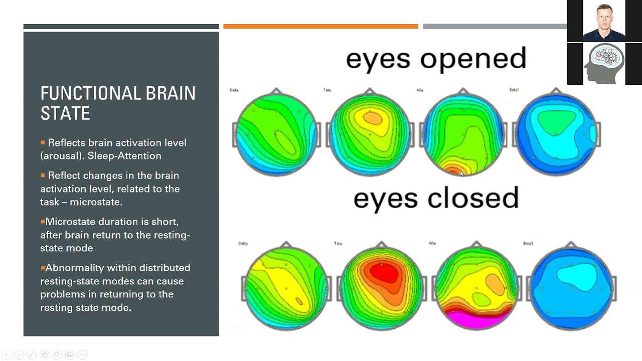 WEBINAR#1: Why you may want to add Functional Brain Mapping techniques to your practice