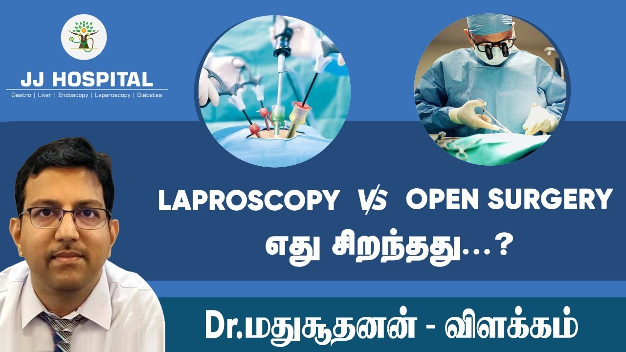Laparoscopy vs open surgery - எது சிறந்தது? தெளிவான விளக்கம்! Dr. Madhusudhanan | J J HOSPITAL