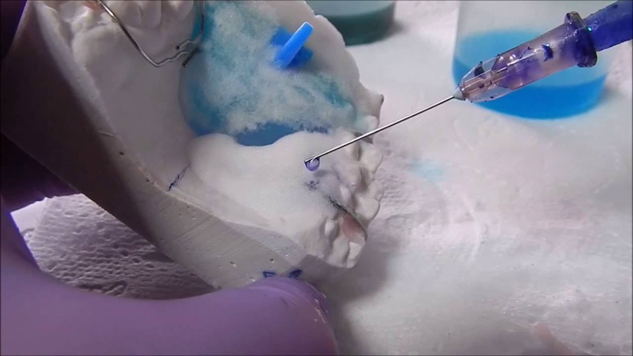 Aparat ortodontyczny (removable orthodontic appliance)