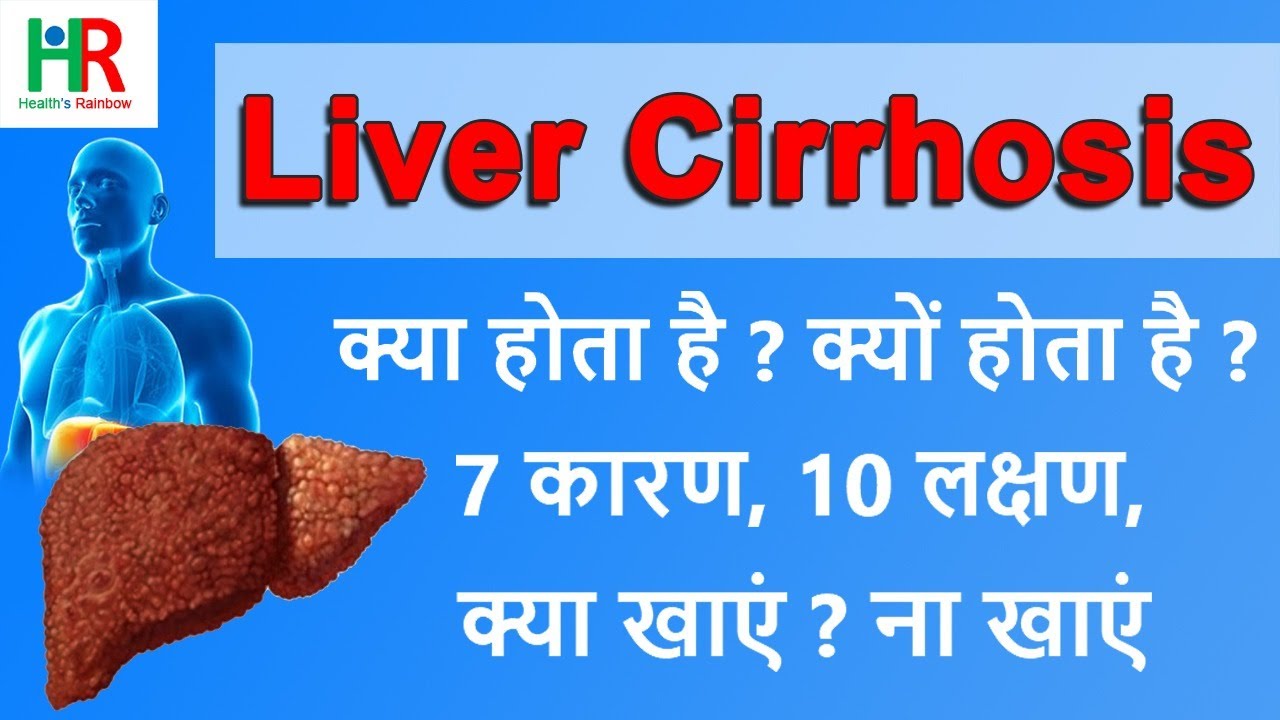 लिवर सिरोसिस क्या होता है | लिवर सिरोसिस क्यों होता है | लिवर सिरोसिस के 7 कारण, 10 लक्षण , Diet |
