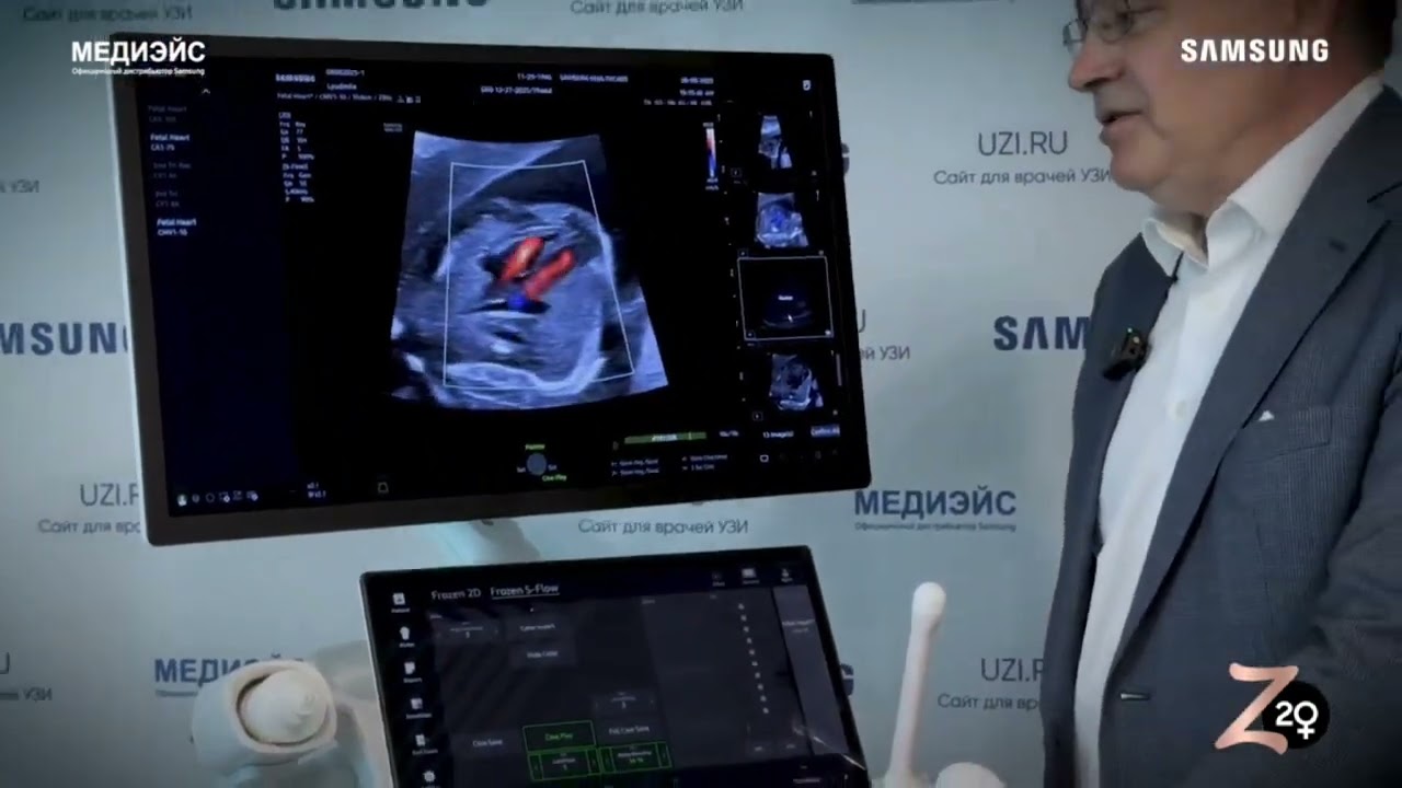 HERA Z20 обзор