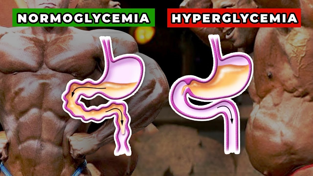 What ACTUALLY Causes Bubble Gut? (GH Gut) Is It Reversible?