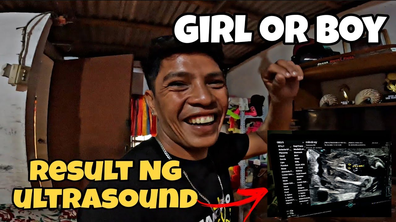 GRABE SOBRANG SAYA KO SA NAGING RESULT NG ULTRASUOND GIRL OR BOY