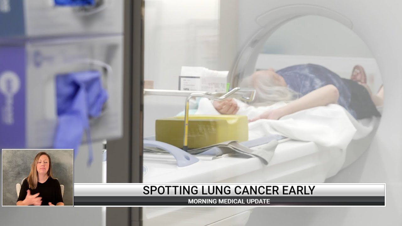 Morning Medical Update: Lung Cancer & Low Dose CT Screening