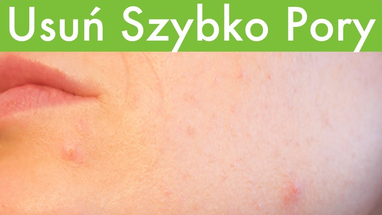 Skuteczny sposób na  ROZSZERZONE I ZATKANE PORY