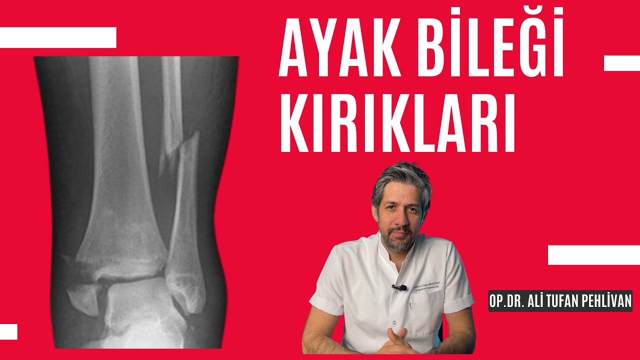 Ayak Bileği Kırıkları