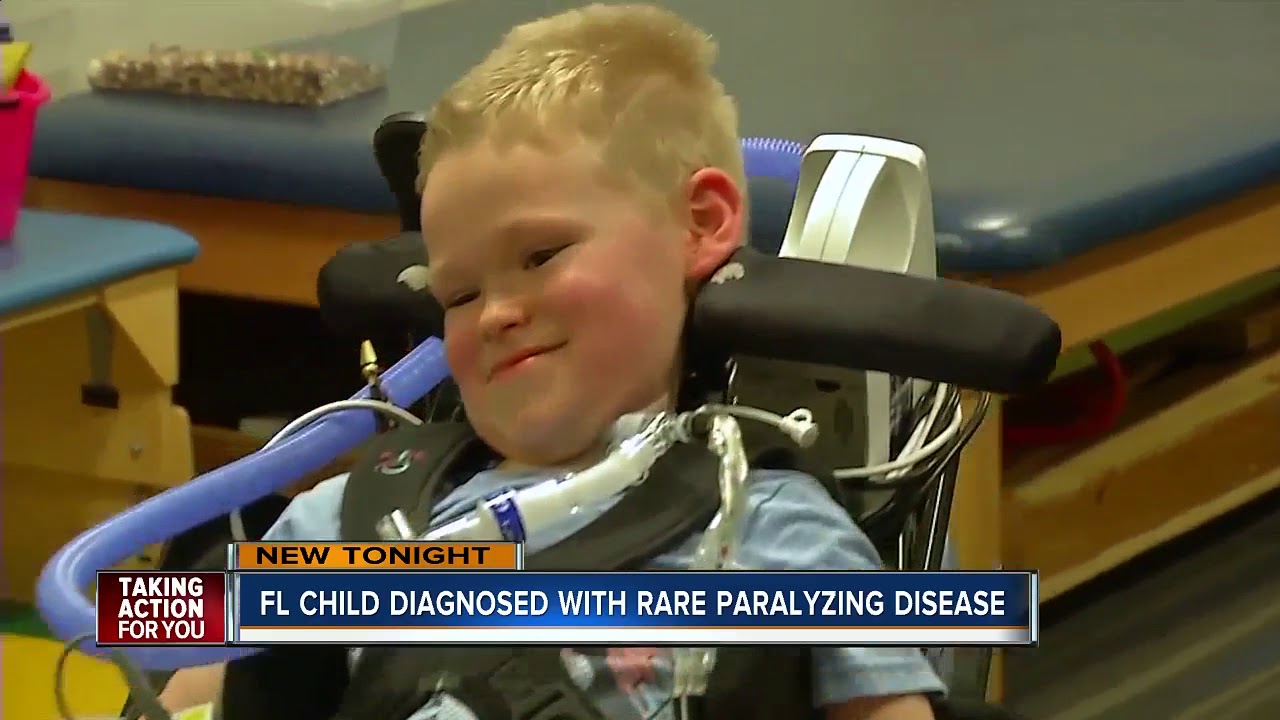 Florida hospital confirms first case of paralyzing polio-like disease found among children in state