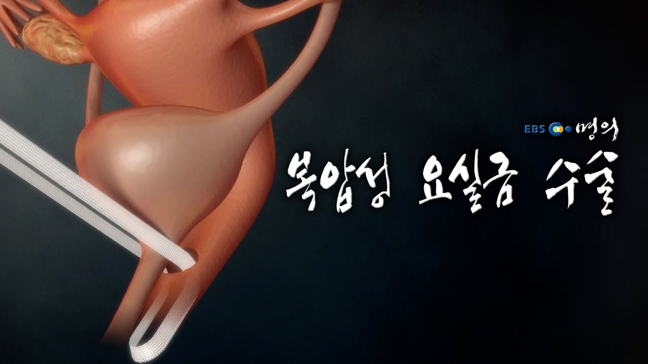 [명의 의학백과📖] 복압성 요실금 수술