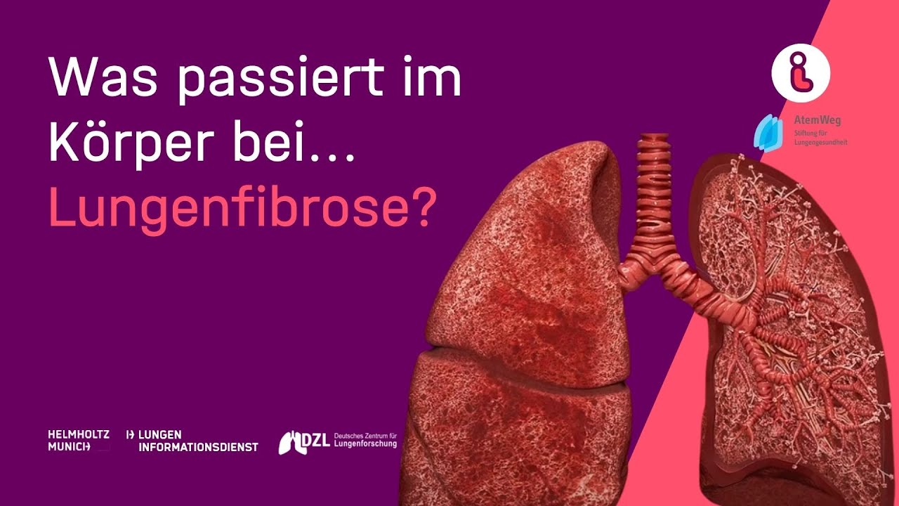 Was passiert im K&ouml;rper bei Lungenfibrose