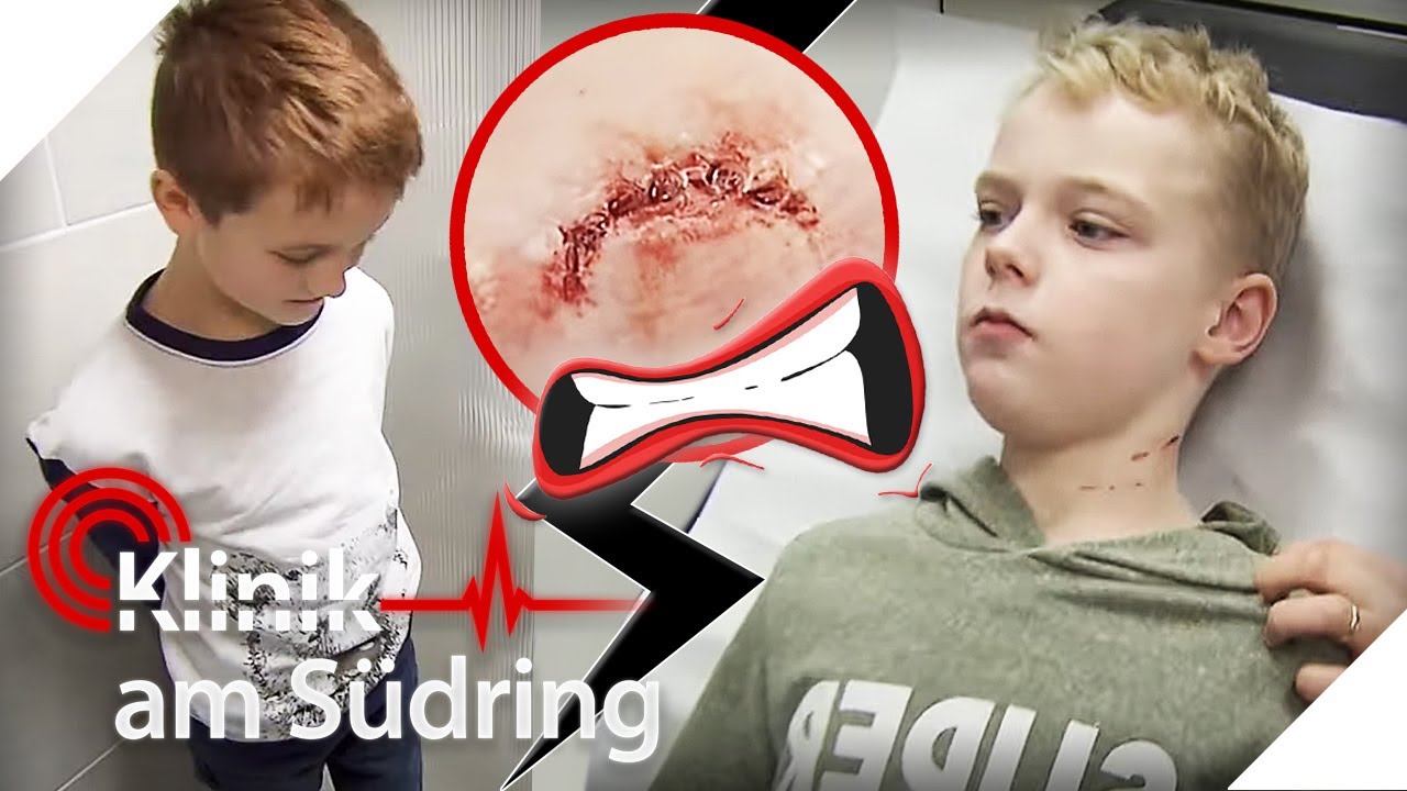 Junge (10) GEBISSEN 🦷 Sind die Brüder im Streit aufeinander los? 💥 | Klinik am Südring | SAT.1