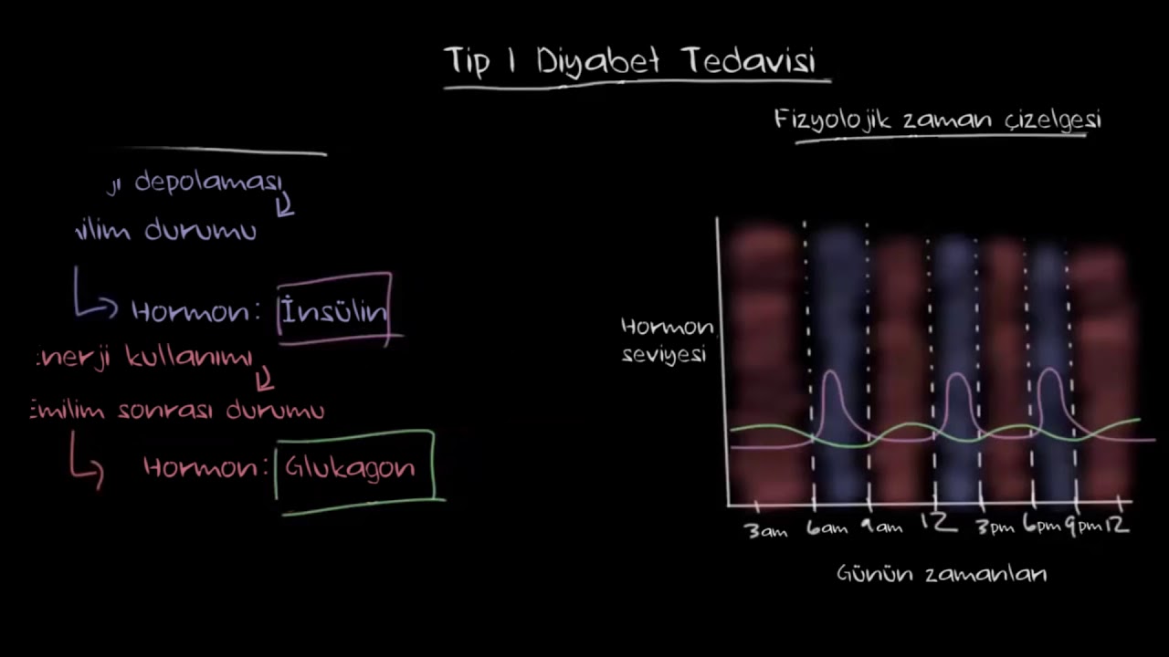 Tip I Diyabet Tedavisi (Fen Bilimleri) (Sağlık ve Tıp)