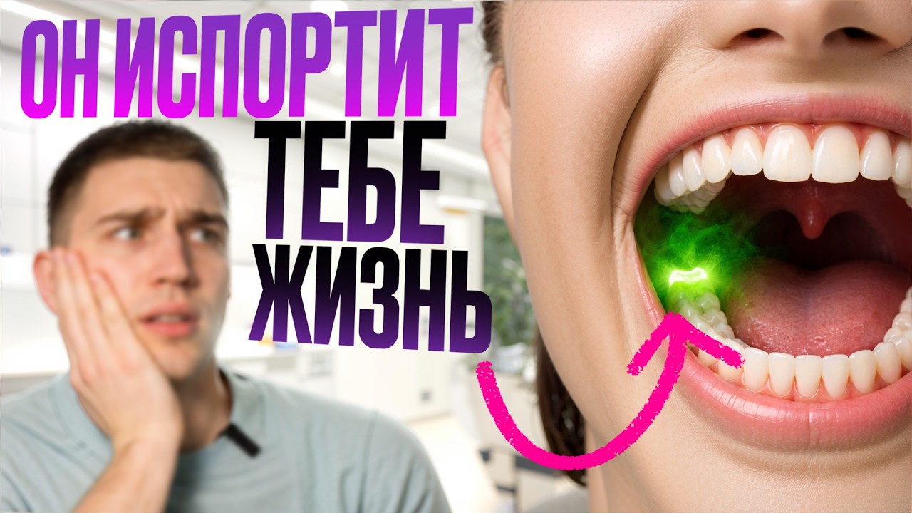 Что скрывают ЗУБЫ МУДРОСТИ? 5 шокирующих угроз для вашего здоровья!