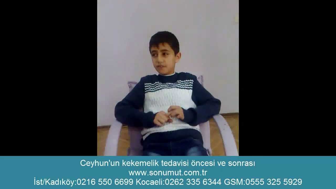 ceyhun'un kekemelik tedavi öncesi ve sonrası
