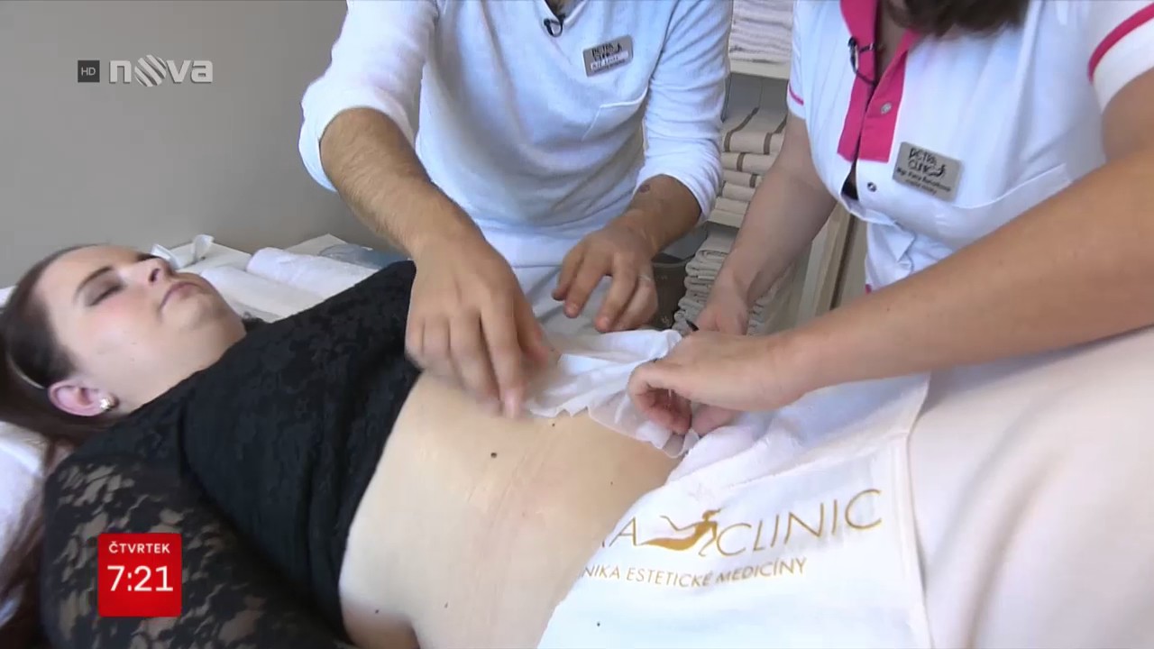 Terapeutem v Petra Clinic: jak vypadá Kryolipolýza.