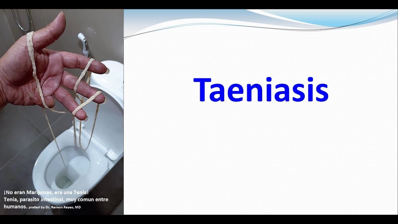 Taeniasis (T.saginata and T.solium)