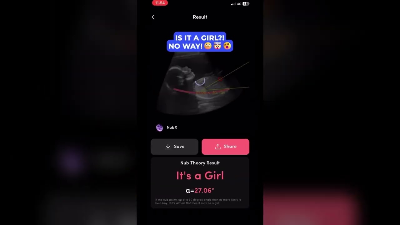 AI Gender Reveal app in the world, NubX #pregnancy  #babygender #genderexpression #pregnant