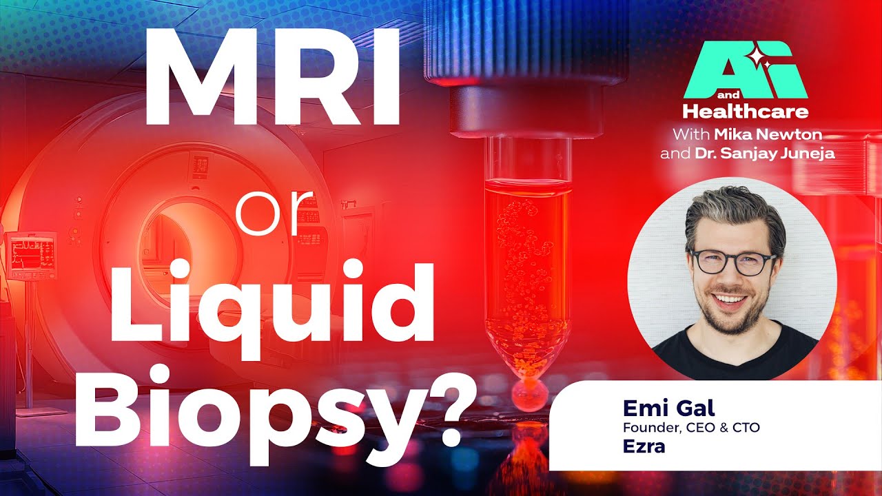 Cancer Detection MRI Imaging vs Blood Tests