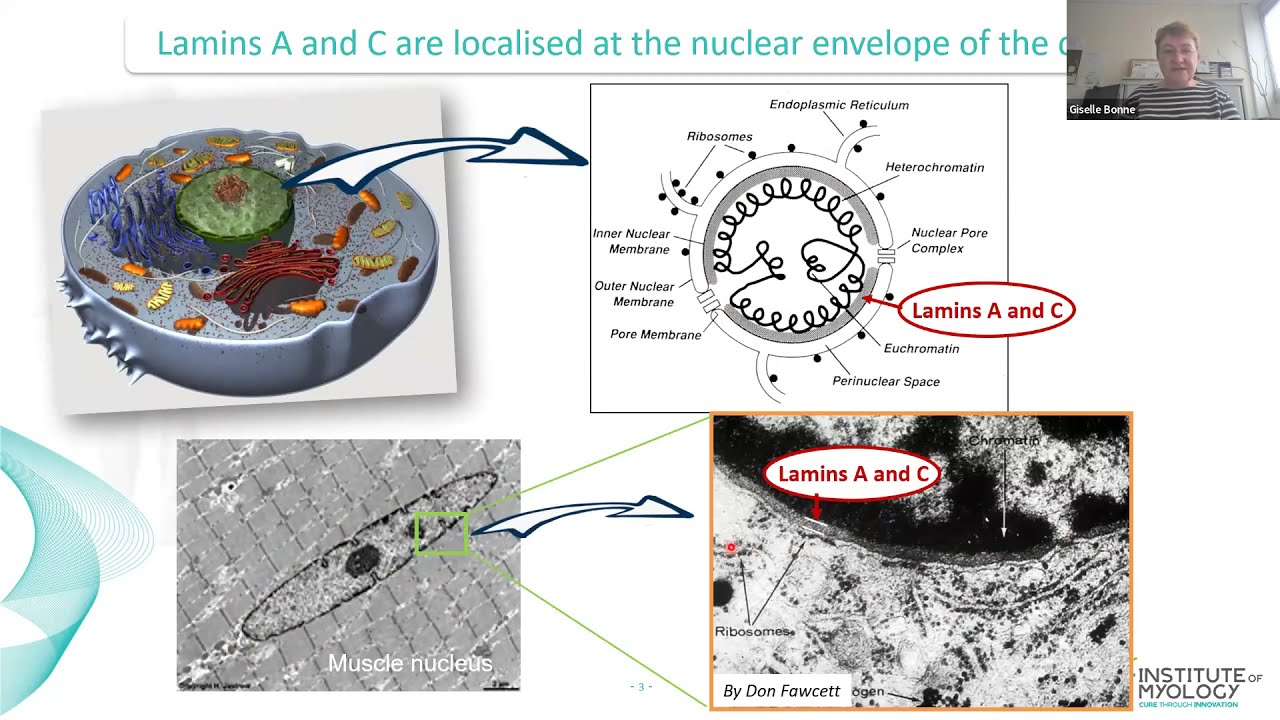 MDUK Muscles Matter 2022: Congenital Muscular Dystrophy