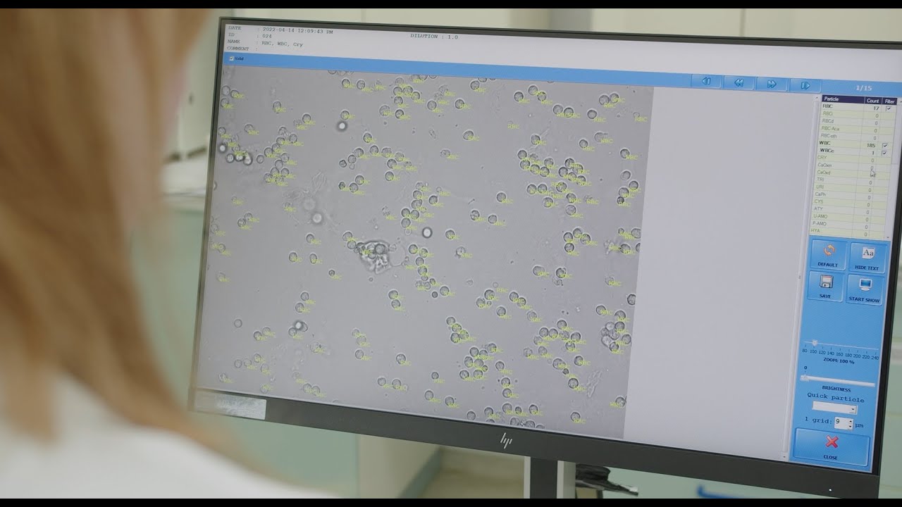 Urilyzer® Cell tutorial 3 - Results management and transfer options