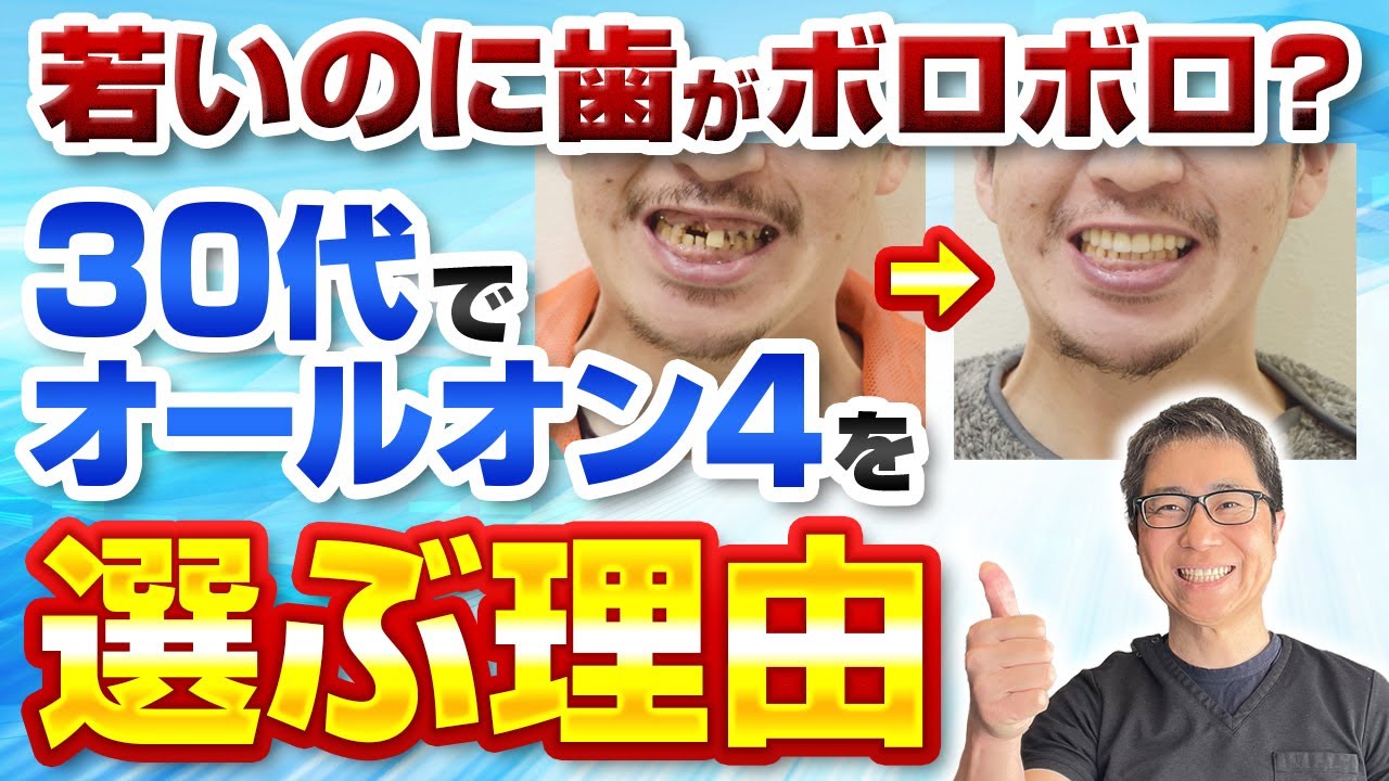 【症例あり】30代がオールオン4を選ぶ理由
