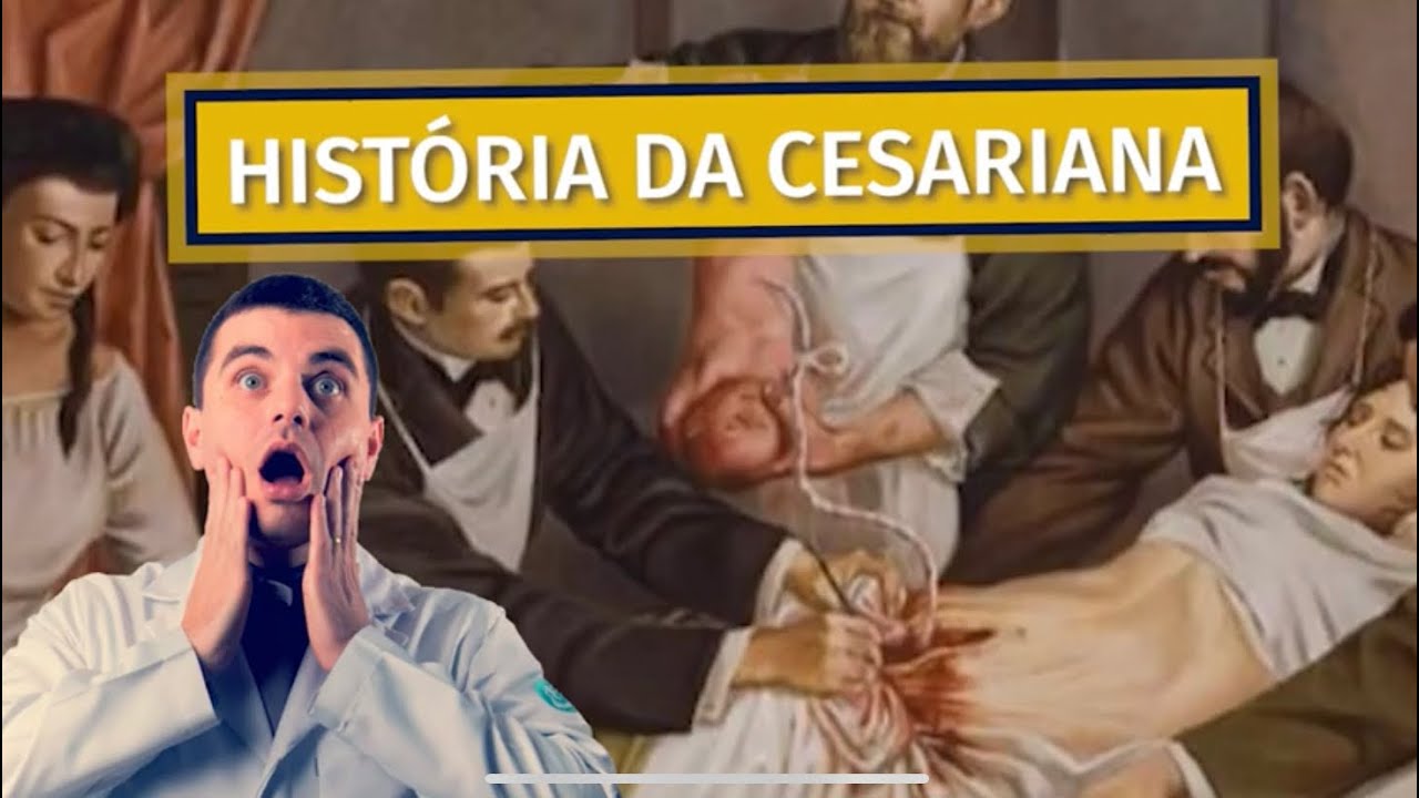A Incrível História da Cesariana  - No Brasil e no Mundo