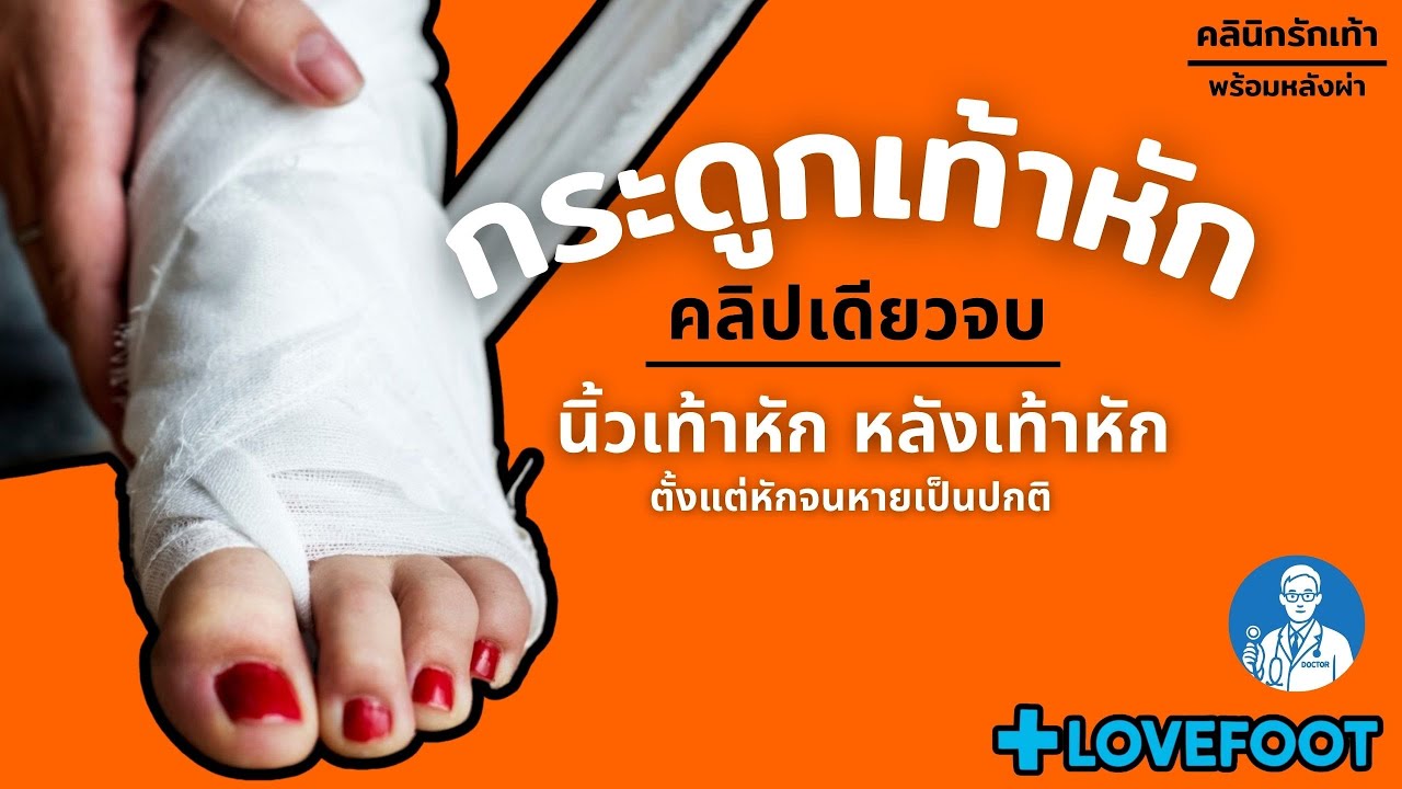 กระดูกนิ้วเท้าหัก กระดูกเท้าหัก กี่วันกระดูกถึงจะติด และต้องรักษาอย่างไร ตั้งแต่หักจนหาย คลิปเดียวจบ