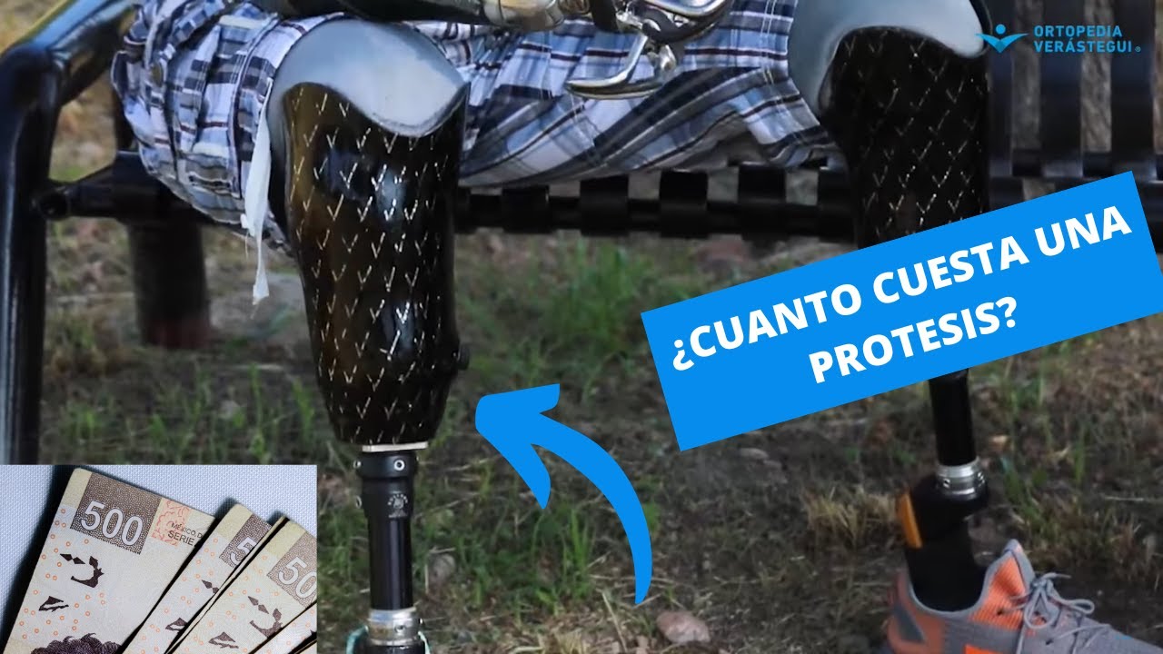 Episodio 141 Cuanto cuesta una prótesis de pierna abajo de rodilla? #prótesis #transtibial