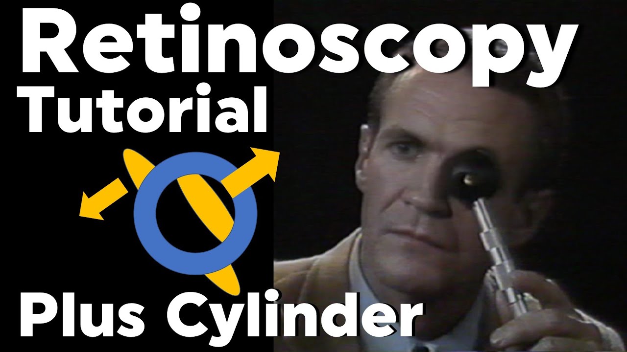Retinoscopy Plus Cylinder Full Tutorial with Phoropter