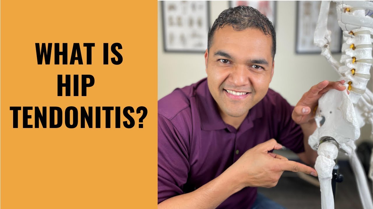 Everything You Need To Know About Hip Tendonitis   Anatomy Symptoms & Causes