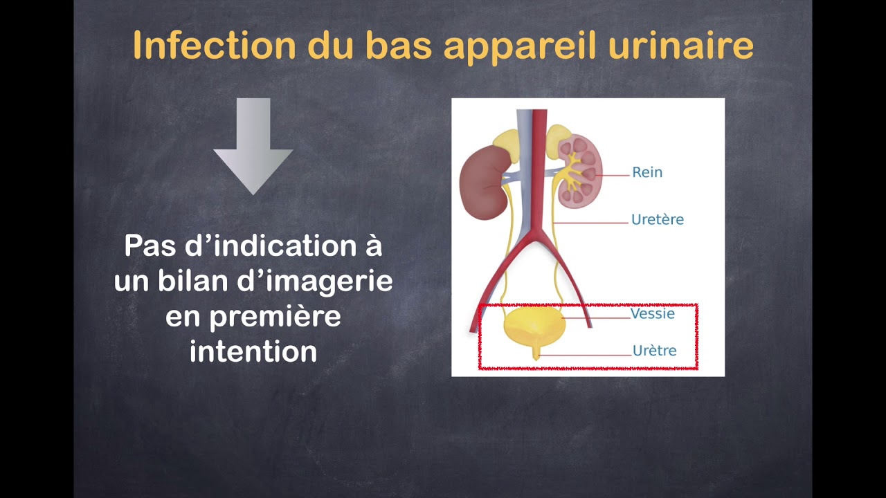 Infections urinaires - 1. Quels examens prescrire