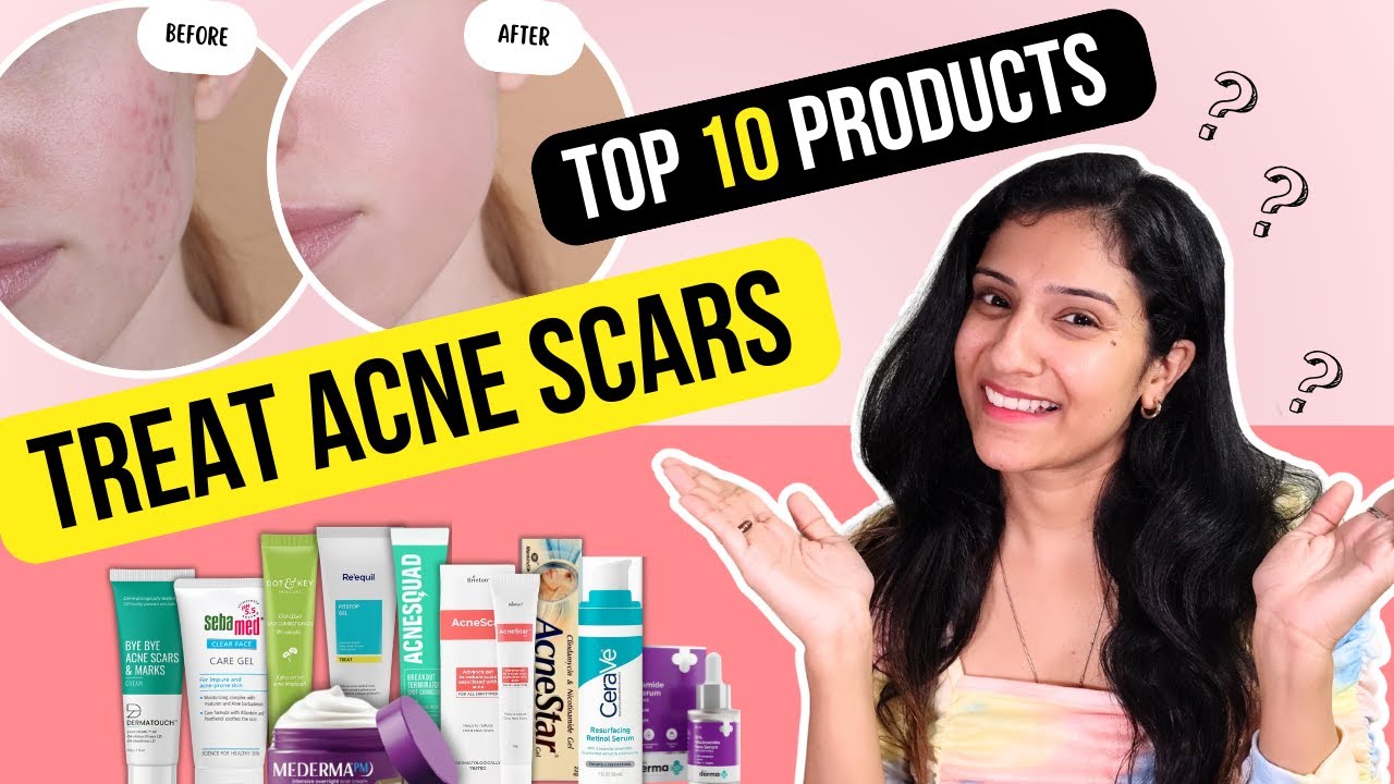 Acne scars treatment - TOP 10 products to treat acne scars quickly and effectively