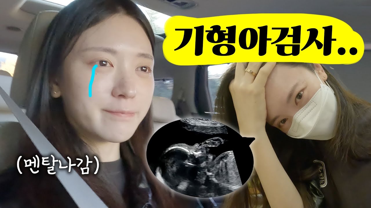 [VLOG] 기형아검사 후 매일 눈물로 보낸 일주일..🥲