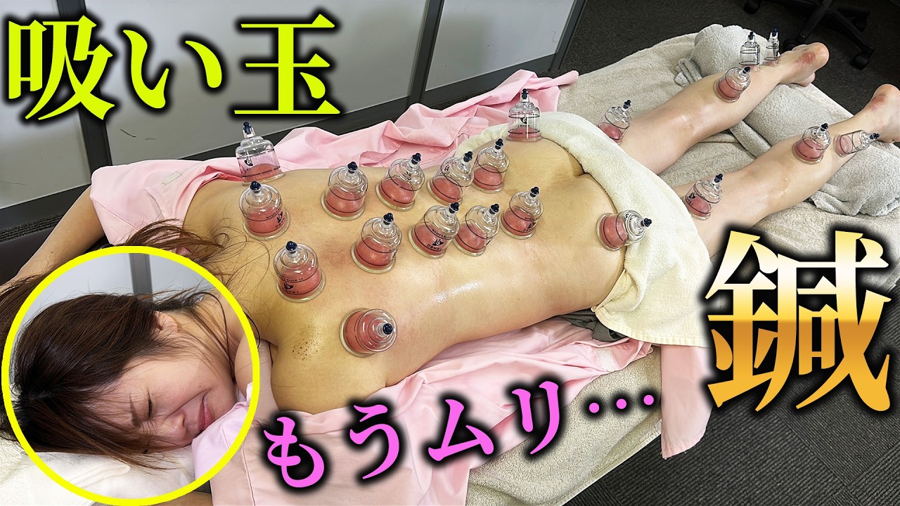 【整体 吸い玉鍼灸】整体と吸い玉鍼灸で１年ぶりのメンテ再開　腰足がボロボロすぎました　腰痛と足のむくみと自律神経治療専門鍼灸院【鍼灸院ブレア銀座・元町　東西医学統合研究所】
