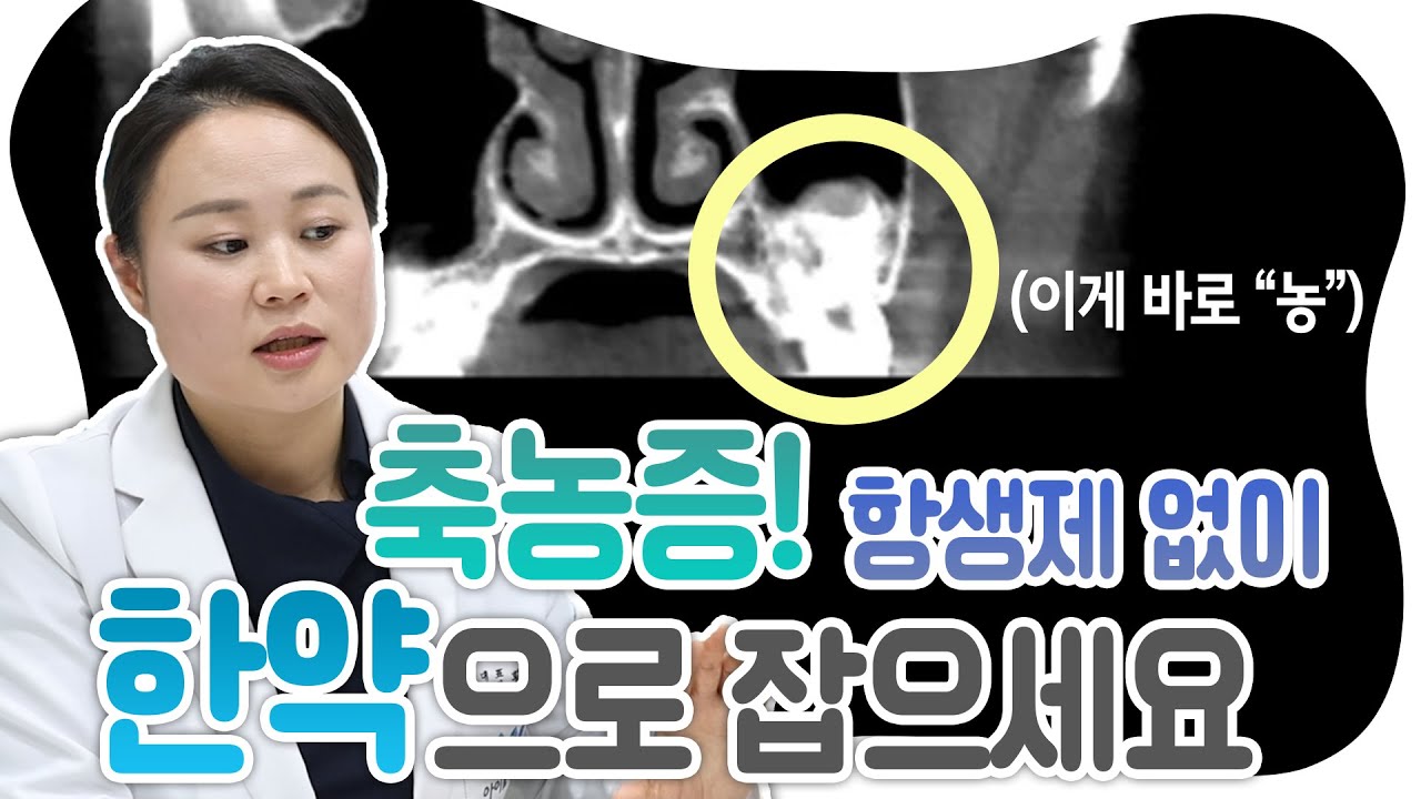 황선애원장, 축농증 치료의 모든것