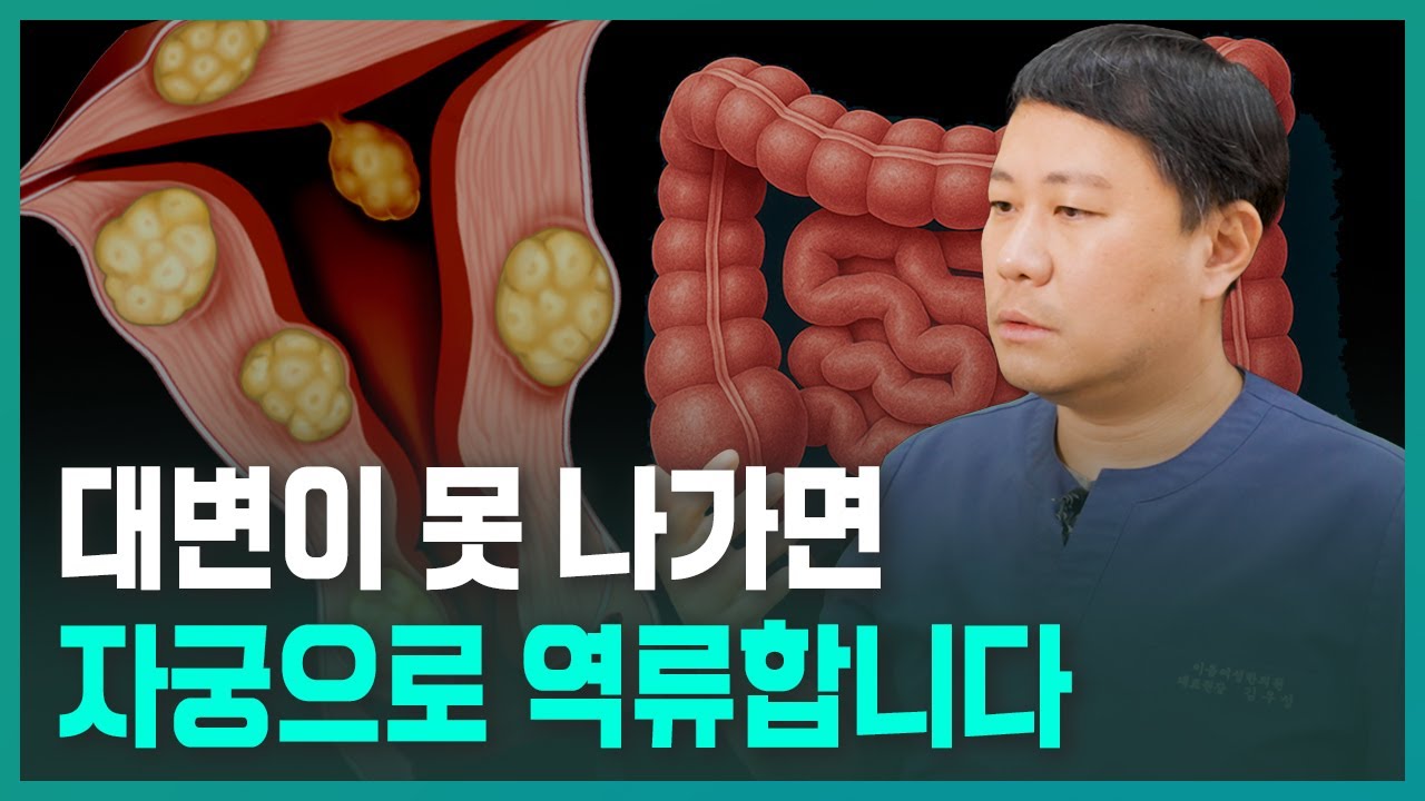 늘 못 본 대변이 자궁 혹을 키운다고? 장독소가 호르몬 역류를 일으킵니다