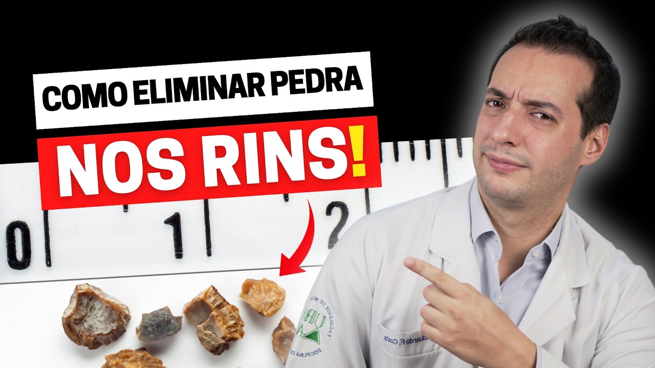 ACABOU A DOR! 5 FORMAS EFICAZES DE ELIMINAR AS PEDRAS NOS RINS