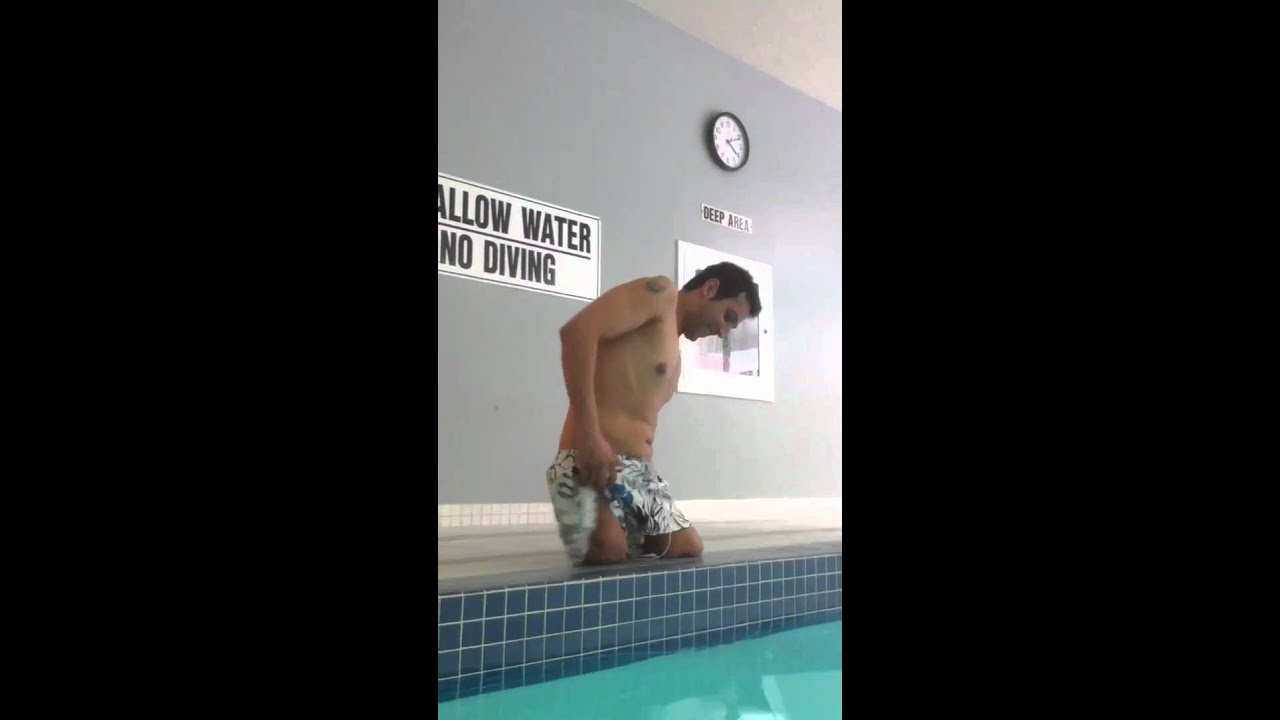 Bilateral amputee above knee walking on the end of his legs