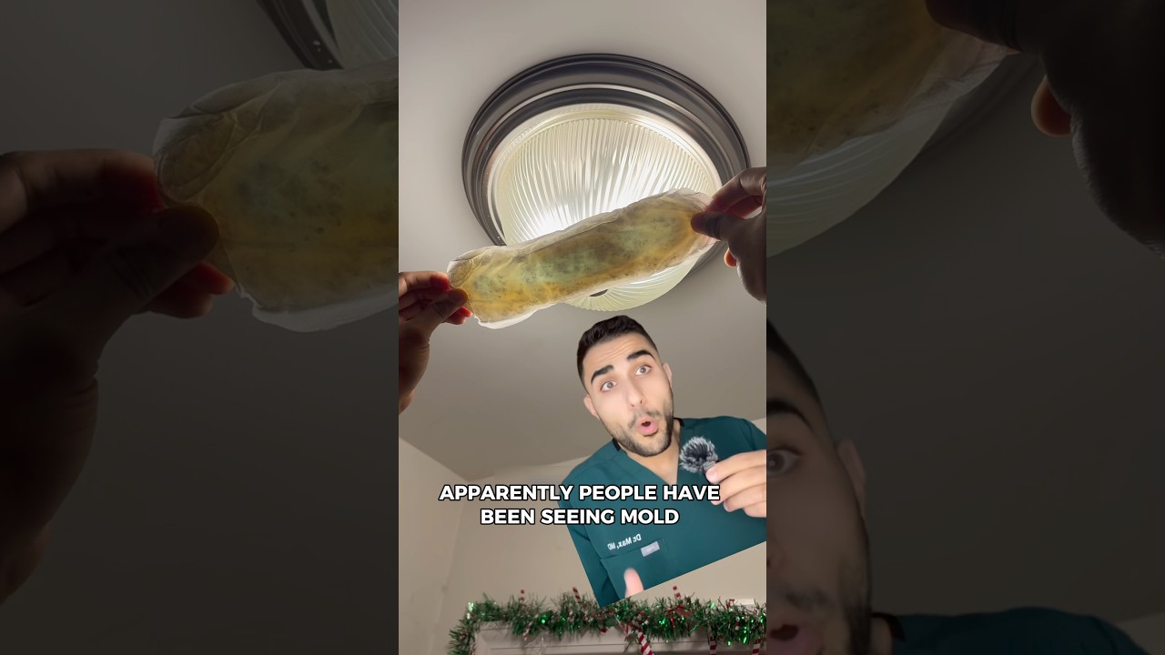 Czy w podpaskach Always są jakieś pleśni?😮😮😮 (Lekarz wyjaśnia)
