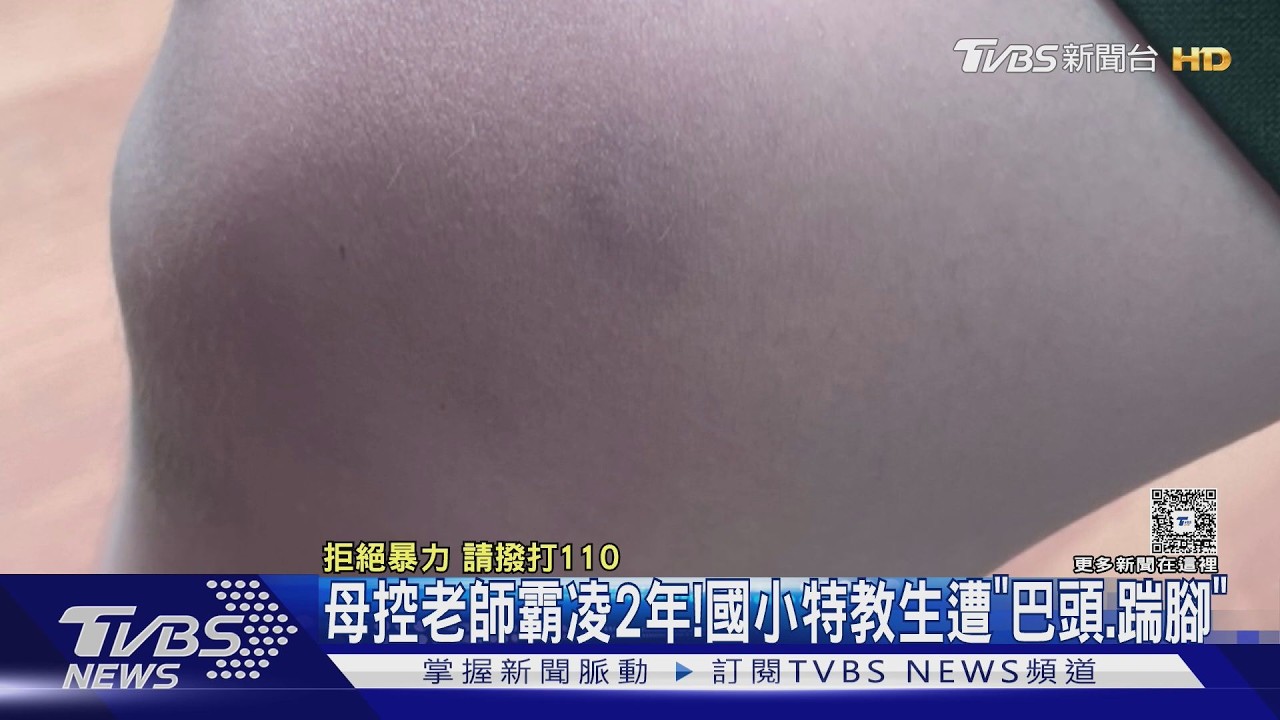 母控老師霸凌兩年!國小特教生遭「巴頭、踹腳」　僅申誡1支｜TVBS新聞 @TVBSNEWS02