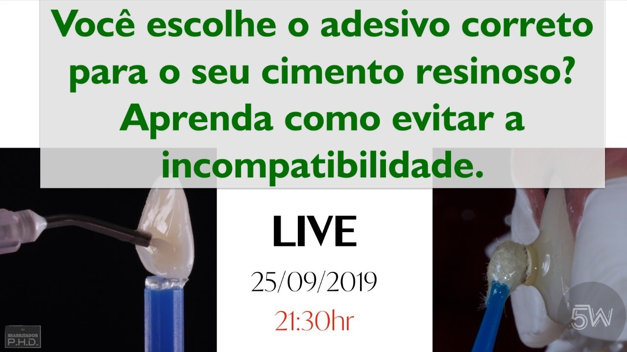 Como escolher o adesivo e cimento resinoso compat&iacute;veis, tendo sucesso nas cimenta&ccedil;&otilde;es