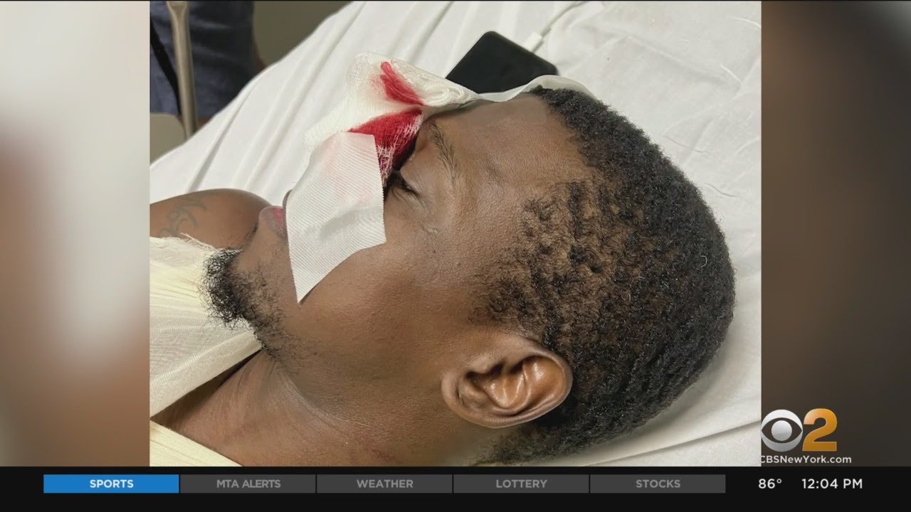 Suspect in vicious attack on subway worker due in Bronx court