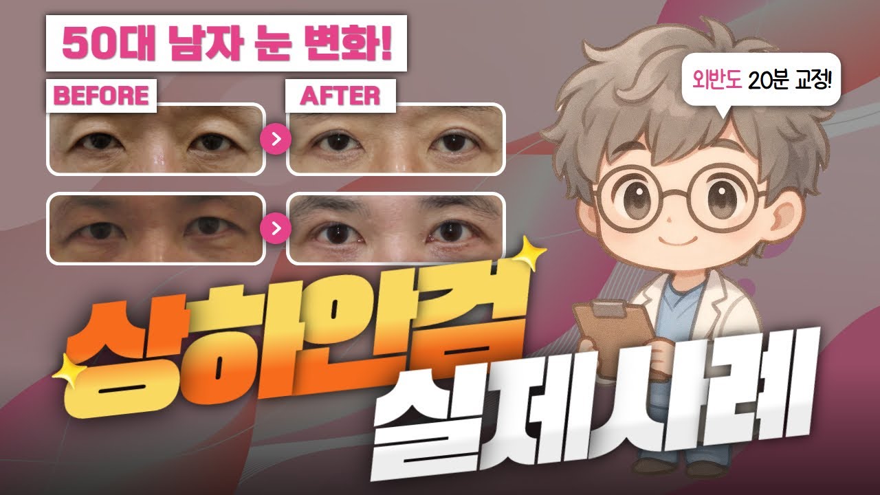 자꾸 눈가가 처지고 무거우신가요? 은둔닥터가 알려주는 눈 성형을 미루면 안 되는 이유