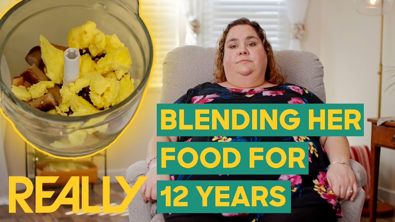 Woman Can't Eat Without VOMITING | Botched Bariatrics