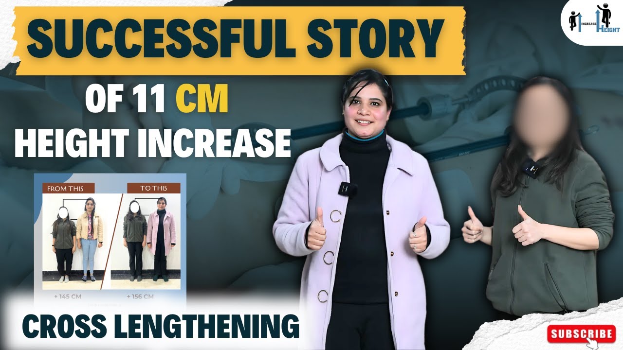 История успеха: увеличение роста на 11 см. Патент Cross Lengthening | Операция по увеличению роста