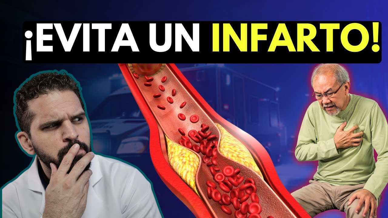 &iquest;C&oacute;mo prevenir un Segundo Infarto? Claves para Proteger tu Coraz&oacute;n?