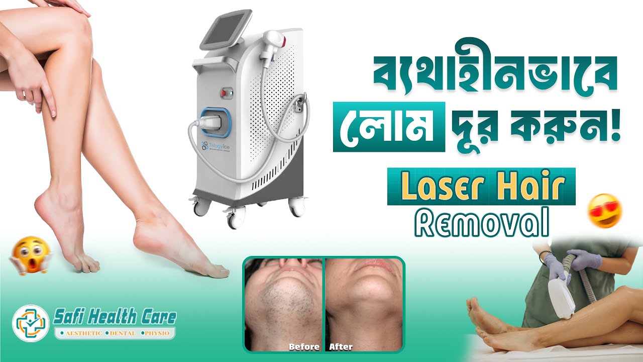 ডিসকাউন্ট অফার।, ডায়োড লেজার – ৩,৫০০ টাকা/সেশন