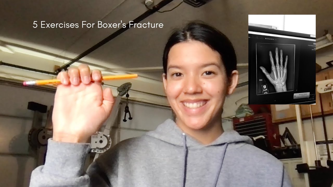 5 Exercises For A Boxer's Fracture